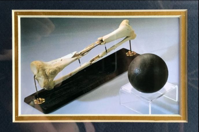 General Daniel Sickles leg artifact from Gettysburg